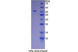 SDS-PAGE analysis of Rat FSTL1 Protein. (FSTL1 蛋白)
