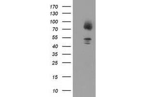 Western Blotting (WB) image for anti-Gephyrin (GPHN) antibody (ABIN1498426) (Gephyrin 抗体)