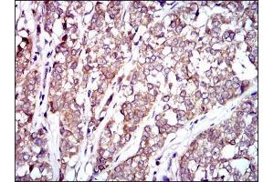 Immunohistochemistry (IHC) image for anti-V-Raf-1 Murine Leukemia Viral Oncogene Homolog 1 (RAF1) antibody (ABIN969560)