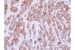 Image no. 2 for anti-Calpastatin (CAST) (AA 275-700) antibody (ABIN1497106) (Calpastatin 抗体  (AA 275-700))