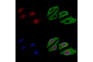 ABIN7093308 and ABIN7097327 staining Hela cells by IF/ICC. (CHEK2 抗体  (C-Term))