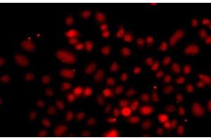Immunofluorescence analysis of A549 cells using RRAGC Polyclonal Antibody (GTR2 抗体)