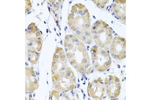 Immunohistochemistry of paraffin-embedded human stomach using CBR4 antibody (ABIN5972931) at dilution of 1/100 (40x lens). (CBR4 抗体)