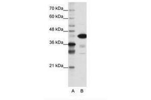 Image no. 1 for anti-TAR DNA Binding Protein (TARDBP) (N-Term) antibody (ABIN202468) (TARDBP 抗体  (N-Term))