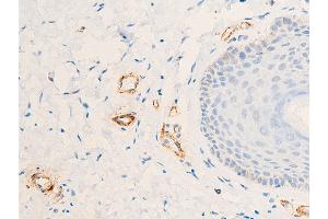 Immunohistochemistry (IHC) image for anti-Actin, alpha 2, Smooth Muscle, Aorta (ACTA2) (N-Term) antibody (ABIN6254917)