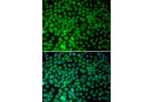 Immunofluorescence analysis of MCF-7 cells using RBX1 antibody. (RBX1 抗体)