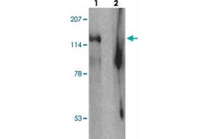 Western blot analysis of SGSM2 in human cerebellum tissue with SGSM2 polyclonal antibody  at 1 ug/mL in (1) the absence and (2) the presence of blocking peptide. (SGSM2 抗体  (Internal Region))