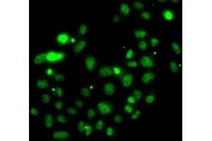 Immunofluorescence analysis of U2OS cells using PMS2 Polyclonal Antibody (PMS2 抗体)