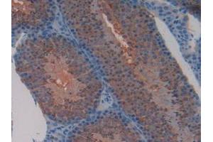IHC-P analysis of Mouse Testis Tissue, with DAB staining. (TFAM 抗体  (AA 43-243))