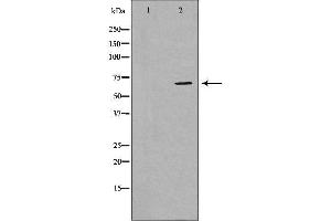 Western blot analysis of Jurkat whole cell lysate, using MSN Antibody. (Moesin 抗体  (C-Term))