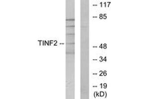 Western blot analysis of extracts from HuvEc cells, using TINF2 Antibody. (TINF2 抗体  (AA 71-120))