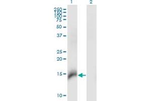 Western Blot analysis of CBY1 expression in transfected 293T cell line by CBY1 monoclonal antibody (M06), clone 2F2. (CBY1/PGEA1 抗体  (AA 18-126))