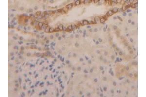 DAB staining on IHC-P; Samples: Rat Kidney Tissue (Cytokeratin 1 抗体  (AA 350-488))
