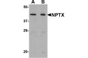 Western Blotting (WB) image for anti-Neuronal Pentraxin II (NPTX2) (Middle Region) antibody (ABIN1031027) (NPTX2 抗体  (Middle Region))