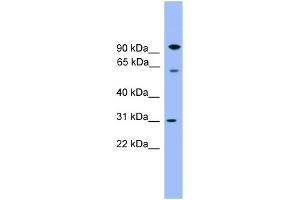 WB Suggested Anti-CPNE6 Antibody Titration: 0. (CPNE6 抗体  (Middle Region))