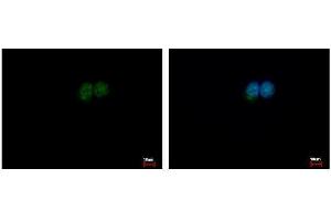 Immunofluorescence (IF) image for anti-Excision Repair Cross-Complementing Rodent Repair Deficiency, Complementation Group 2 (ERCC2) (Internal Region) antibody (ABIN2856090)