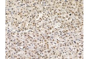 ABIN6258502 and ABIN6274615 at 1/100 staining Rat ovarian tissue by IHC-P. (CDCA2 抗体  (Internal Region))