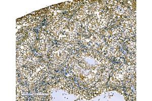 IHC analysis of Ezrin/EZR using anti-Ezrin/EZR antibody (ABIN7603214). (Ezrin 抗体  (N-Term))