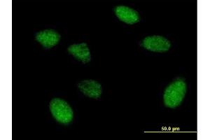Immunofluorescence of purified MaxPab antibody to EIF5A2 on HeLa cell. (EIF5A2 抗体  (AA 1-153))