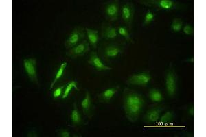 Image no. 4 for anti-serine/threonine Kinase 4 (STK4) (AA 1-40) antibody (ABIN598949) (STK4 抗体  (AA 1-40))