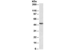 Western blot testing of human lung lysate with TNFR1 antibody at 0. (TNFRSF1A 抗体)