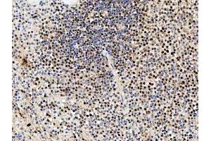 IHC analysis of SDE2 using anti-SDE2 antibody (ABIN7599603). (C1orf55 抗体  (AA 10-447))