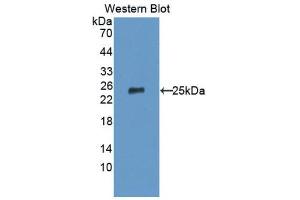 Western Blotting (WB) image for anti-Tumor Necrosis Factor Receptor Superfamily, Member 14 (TNFRSF14) (AA 45-262) antibody (ABIN1176210) (HVEM 抗体  (AA 45-262))