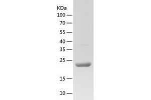 Western Blotting (WB) image for Ankyrin Repeat Domain 44 (ANKRD44) (AA 37-262) protein (His tag) (ABIN7121839) (ANKRD44 Protein (AA 37-262) (His tag))