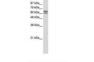 Image no. 3 for anti-Nucleus Accumbens Associated 1, BEN and BTB (POZ) Domain Containing (NACC1) (C-Term) antibody (ABIN202717)