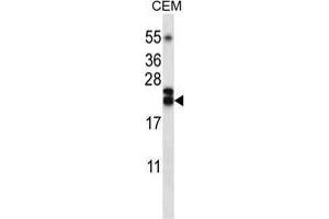 TNFSF4 Antibody (Center) western blot analysis in CEM cell line lysates (35 µg/lane). (TNFSF4 抗体  (Middle Region))