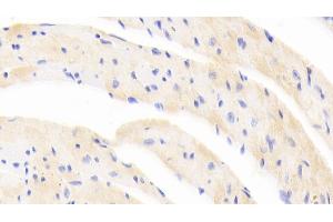 Detection of EPOR in Mouse Cardiac Muscle Tissue using Polyclonal Antibody to Erythropoietin Receptor (EPOR) (EPOR 抗体  (AA 45-244))
