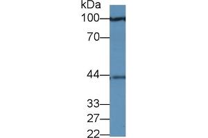 Detection of PRAME in Human 293T cell lysate using Polyclonal Antibody to Preferentially Expressed Antigen In Melanoma (PRAME) (PRAME 抗体  (AA 416-502))