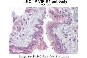 Image no. 1 for anti-Vasoactive Intestinal Peptide Receptor 1 (VIPR1) antibody (ABIN375279) (VIPR1 抗体)