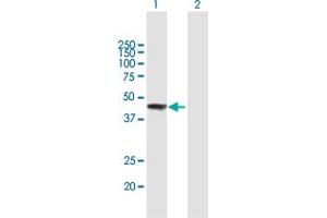 Western Blot analysis of ZCCHC11 expression in transfected 293T cell line by ZCCHC11 MaxPab polyclonal antibody. (ZCCHC11 抗体  (AA 1-309))