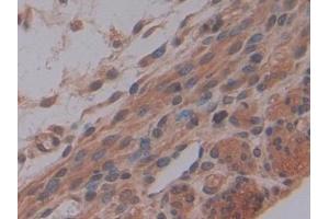 Detection of MMP7 in Mouse Uterus Tissue using Polyclonal Antibody to Matrix Metalloproteinase 7 (MMP7) (MMP7 抗体  (AA 1-264))