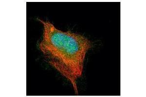 ICC/IF Image Confocal immunofluorescence analysis (Olympus FV10i) of paraformaldehyde-fixed HeLa, using AChE, antibody (Green) at 1:500 dilution. (Acetylcholinesterase 抗体  (C-Term))