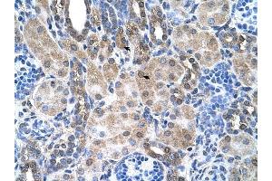 SLC6A18 antibody was used for immunohistochemistry at a concentration of 4-8 ug/ml to stain Epithelial cells of renal tubule (arrows) in Human Kidney.