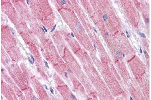 Human Heart: Formalin-Fixed, Paraffin-Embedded (FFPE) (RHBDD3 抗体  (Internal Region))