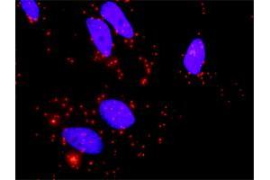 Proximity Ligation Analysis of protein-protein interactions between TGFB2 and BMP2. (BMP2 抗体  (AA 283-396))