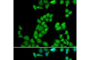 Immunofluorescence analysis of MCF-7 cells using RNASE13 Polyclonal Antibody (RNASE13 抗体)