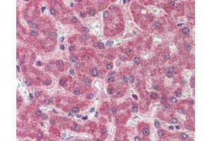 Factor II antibody was used for immunohistochemistry at a concentration of 4-8 ug/ml. (Factor II 抗体)