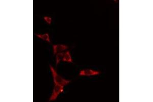 ABIN6275083 staining HeLa cells by IF/ICC. (DNAL1 抗体  (Internal Region))