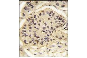 Immunohistochemistry (IHC) image for anti-SRY (Sex Determining Region Y)-Box 2 (SOX2) antibody (ABIN356387)