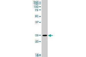 RAB33B monoclonal antibody (M01), clone 6F4. (RAB33B 抗体  (AA 117-206))