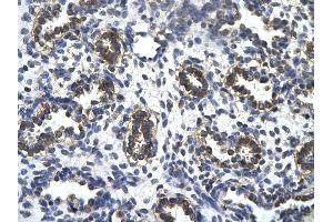 Rabbit Anti-TAF5L Antibody       Paraffin Embedded Tissue:  Human alveolar cell   Cellular Data:  Epithelial cells of renal tubule  Antibody Concentration:   4. (TAF5L 抗体  (N-Term))