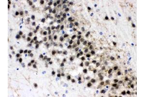 ZWINT was detected in paraffin-embedded sections of rat brain tissues using rabbit anti- ZWINT Antigen Affinity purified polyclonal antibody (Catalog # ) at 1 µg/mL. (ZWINT 抗体  (AA 29-249))