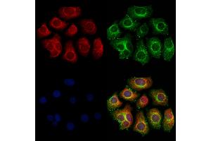 ABIN6260975 and ABIN6273213 staining Hela cells by IF/ICC. (COQ9 抗体  (Internal Region))