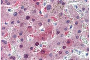 Human Liver: Formalin-Fixed, Paraffin-Embedded (FFPE) (GSTA1 抗体  (AA 1-222))