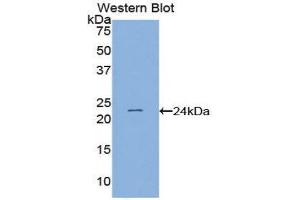 Western Blotting (WB) image for anti-PC4 and SFRS1 Interacting Protein 1 (PSIP1) (AA 311-469) antibody (ABIN1859640) (PSIP1 抗体  (AA 311-469))