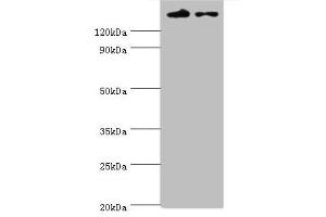 Western blot All lanes: SETDB1 antibody at 5 μg/mL Lane 1: Rat adrenal gland tissue Lane 2: 293T whole cell lysate Secondary Goat polyclonal to rabbit IgG at 1/10000 dilution Predicted band size: 144, 45 kDa Observed band size: 144 kDa (SETDB1 抗体  (AA 1-397))